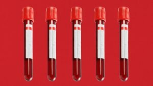 Nepal Red Cross Grapples with Rising HIV Reactive Samples in Jhapa